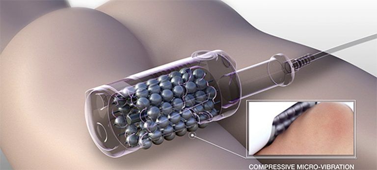 microvibracion-compresiva-gluteos81