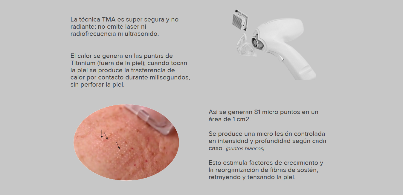 tecnica_TMA_Thermo-Mechanical_Ablation36