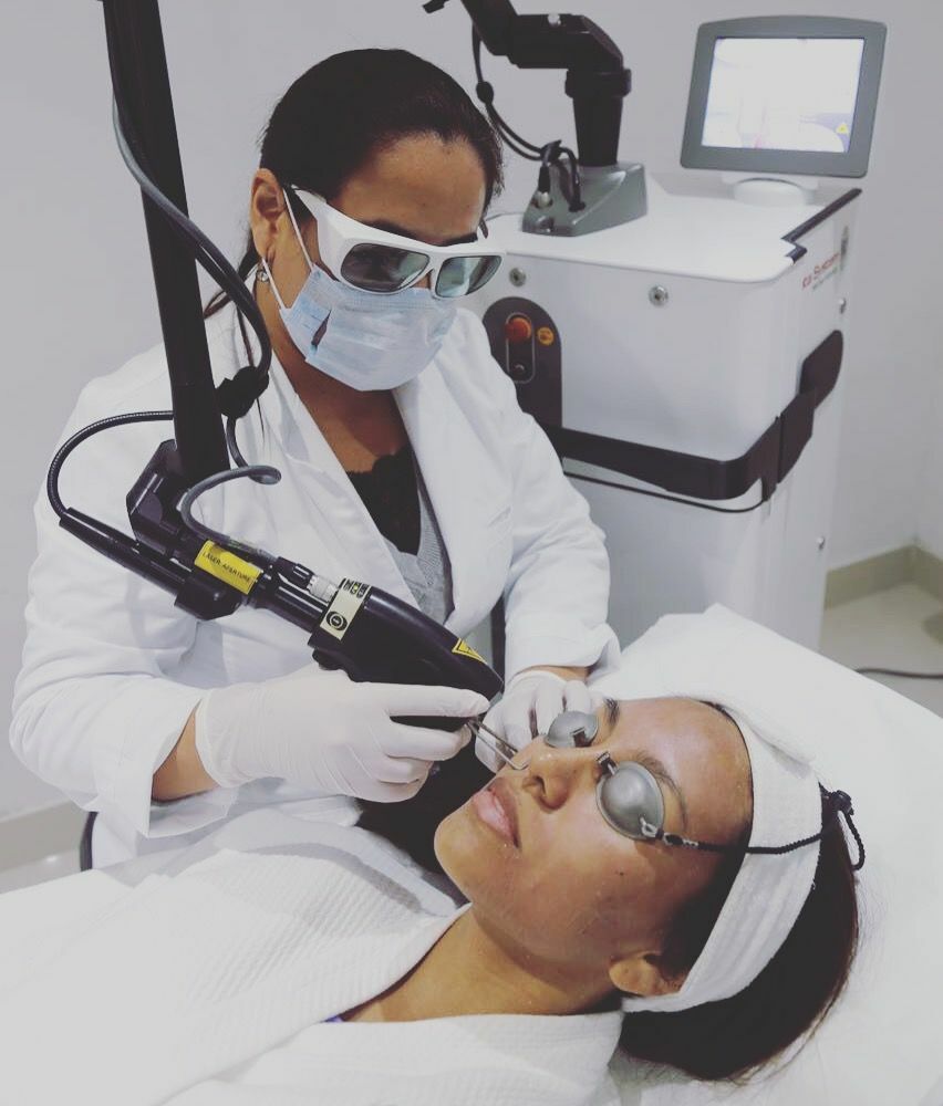 laser_co2_fraccionado